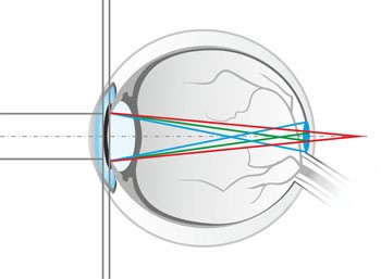 Brilletjes tegen smartphonelicht Fieret Optiek